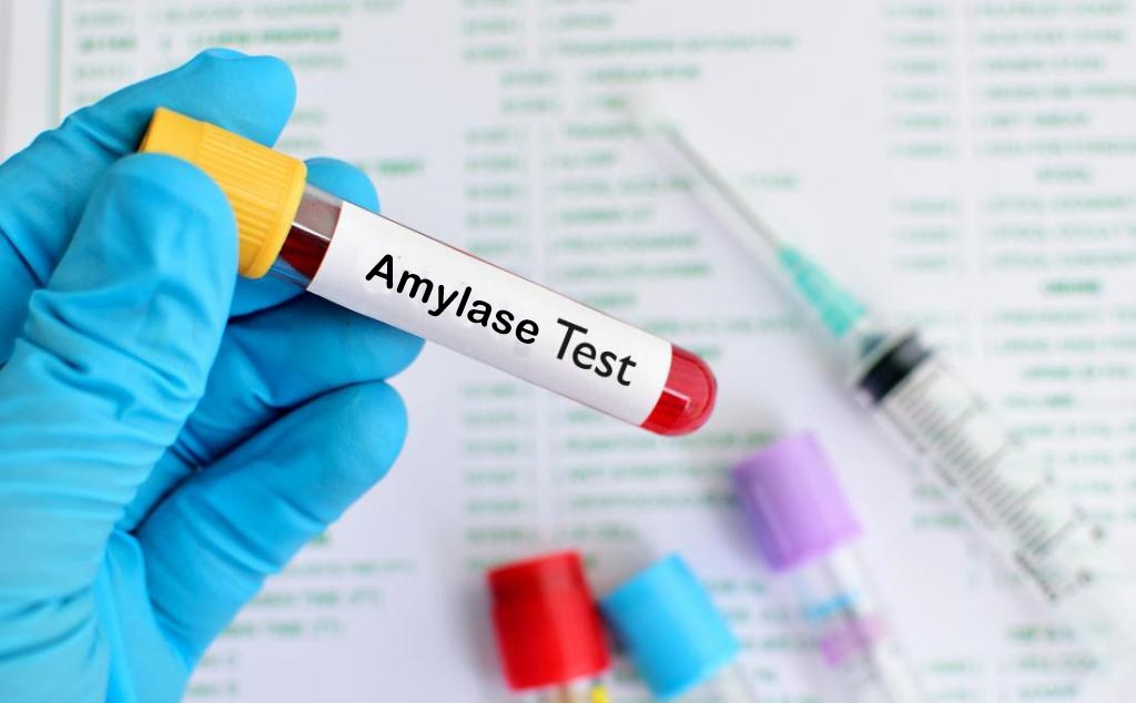 Amylase Blood Test