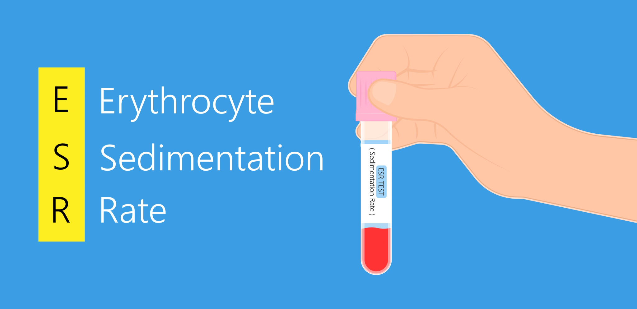 erythrocyte-sedimentation-rate-esr-purpose-procedure-lti