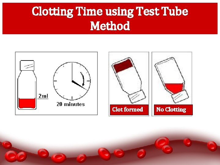 clotting-time-ct-purpose-procedure-results-risks-and-lti