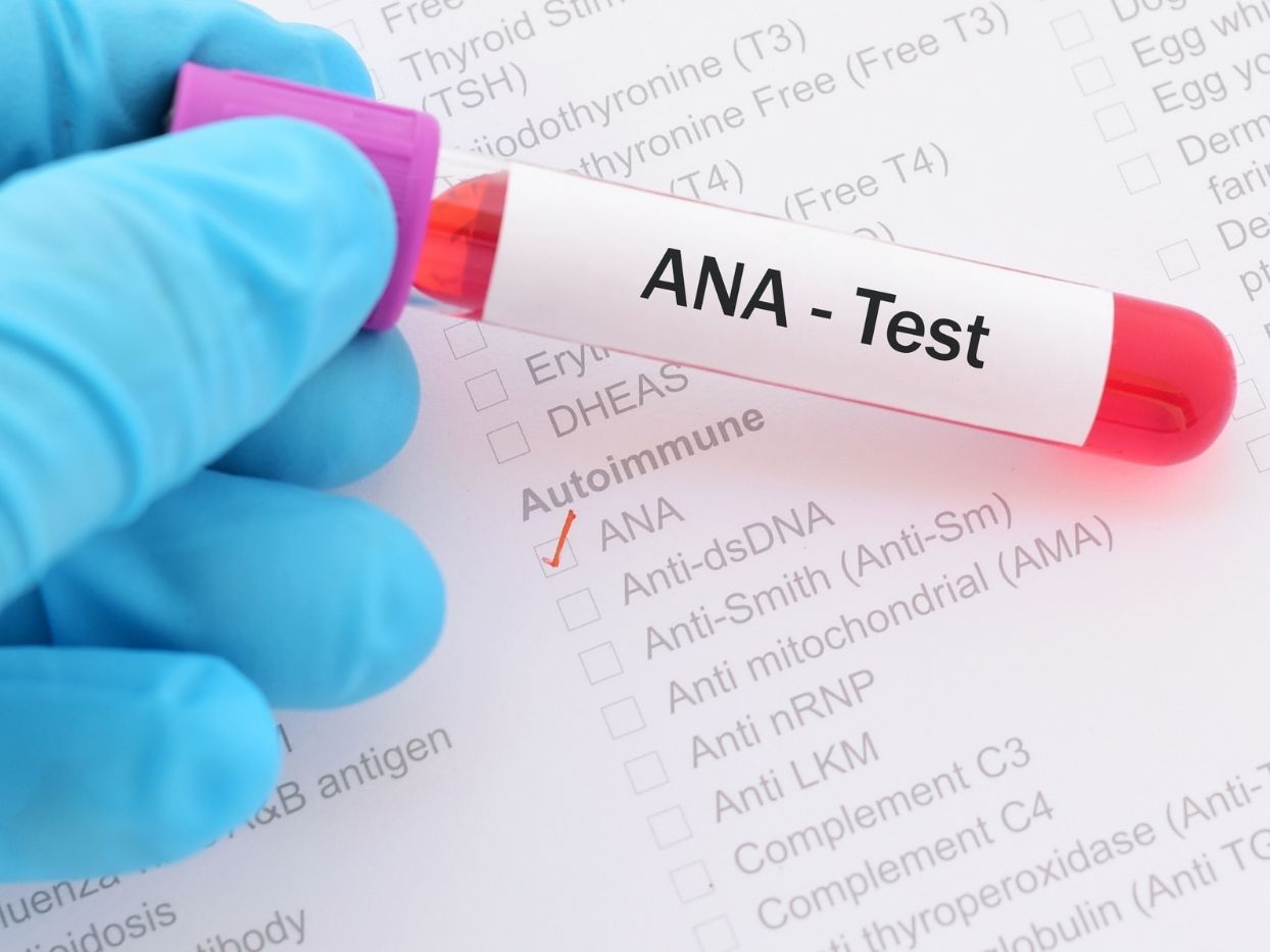 ANA Antinuclear Antibody