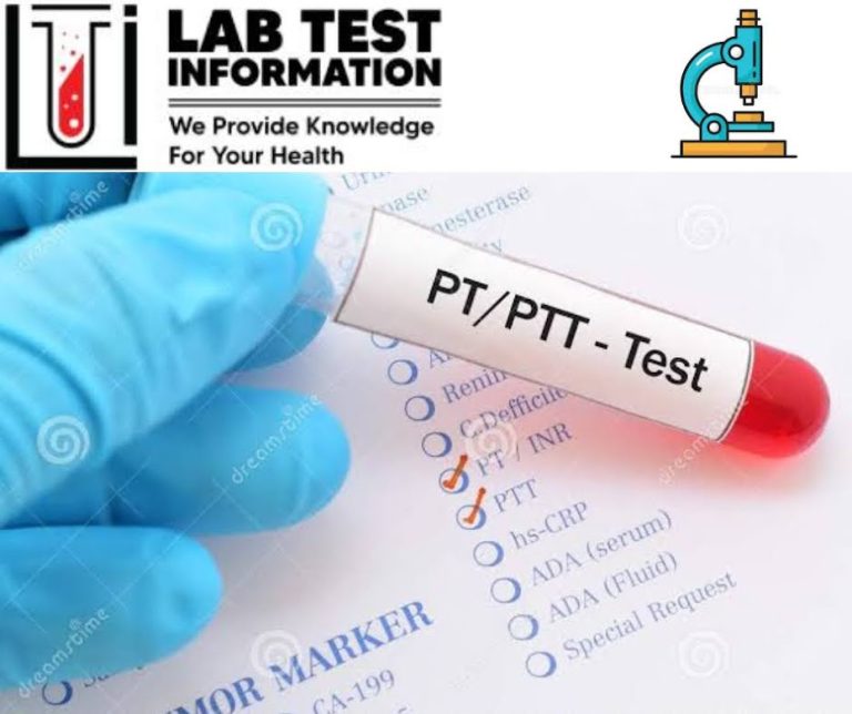 APTT Blood Test