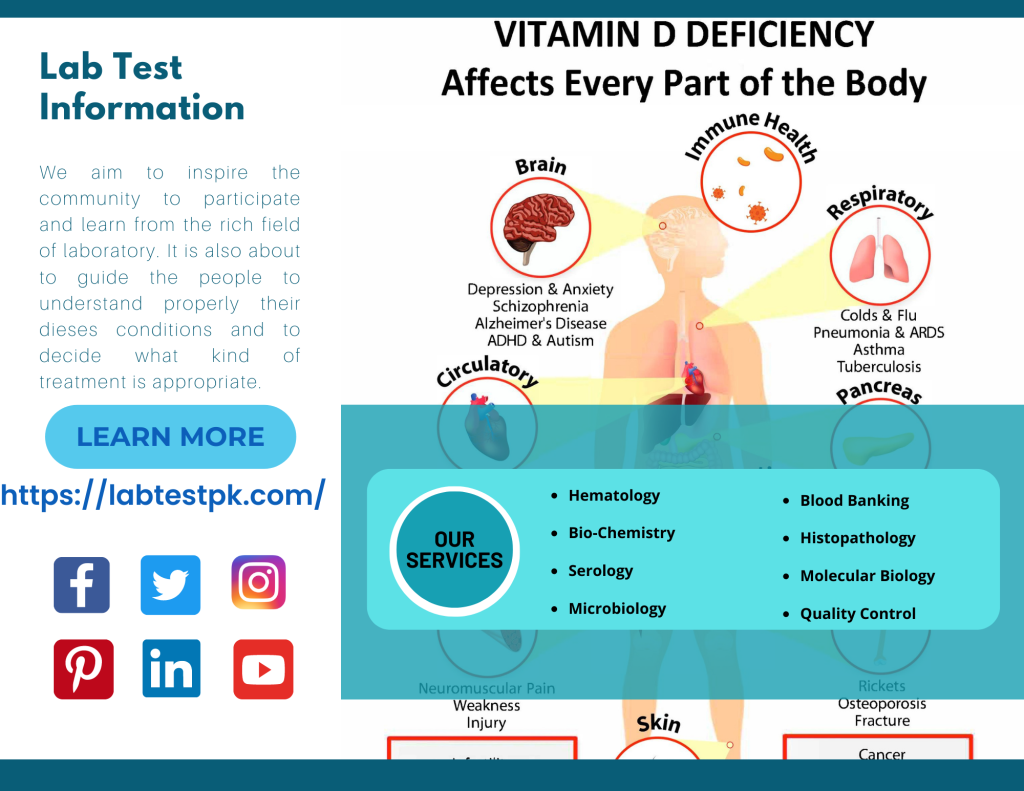 Vitamin D Purpose, Procedure, Results Lab Test Information