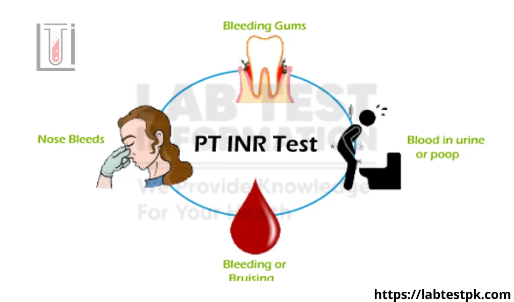 INR Blood Test Prothrombin Time Lab Test Information