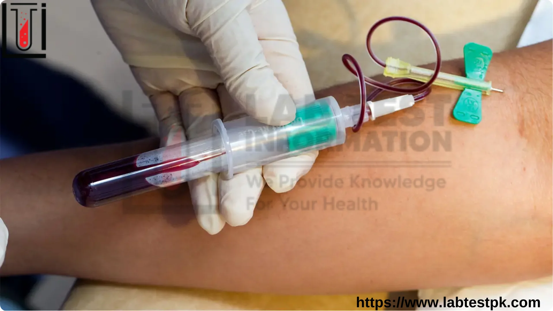 Anion-Gap Blood Test