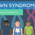 Understanding Down Syndrome Causes, Symptoms, and Support Strategies