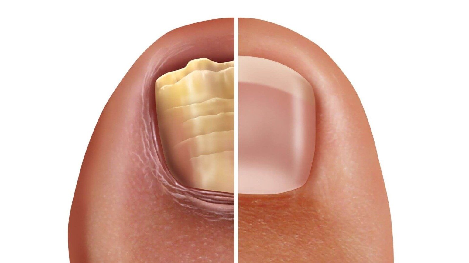 Skin Lesion KOH Exam